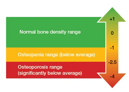 Bone Density ranges