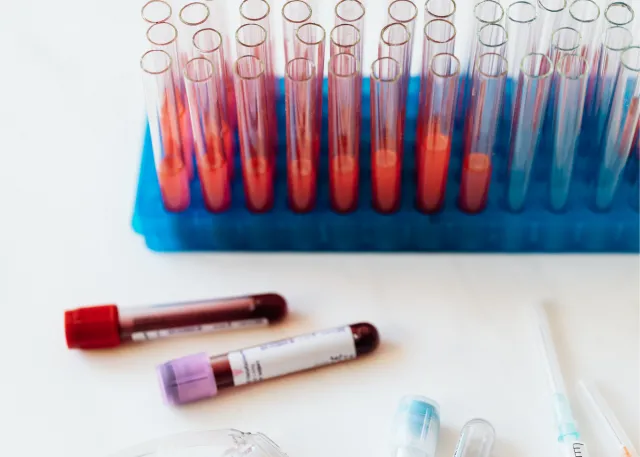 blood samples in vials