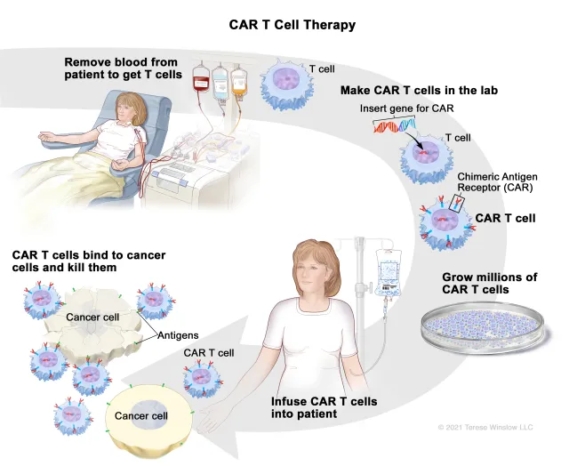 Car T Cell Therapy Steps