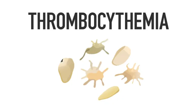 Thrombocythemia