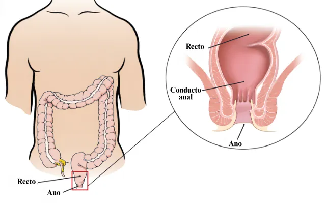 Anal Cancer Graphic ES 
