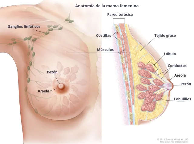 Breast cancer diagram