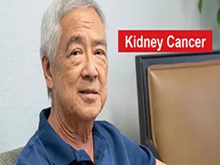 kidney cancer