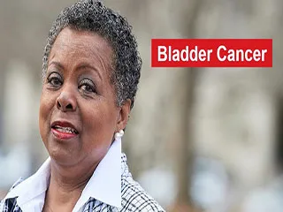 bladder cancer