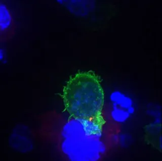 killer t cell
