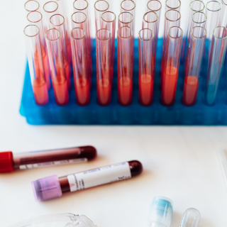 blood samples in vials