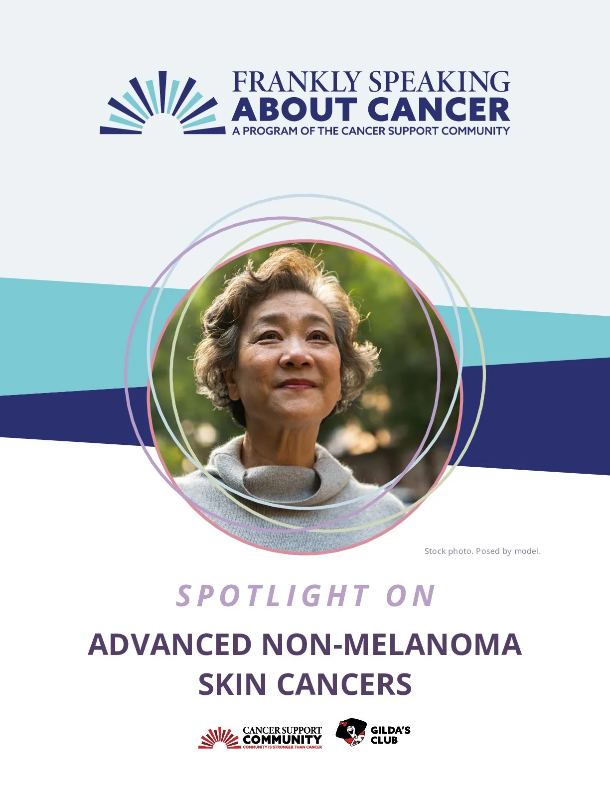 Spotlight on Advanced Non-Melanoma Skin Cancer 