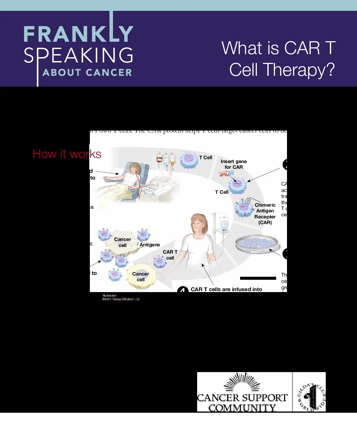 What is CAR T Cell Therapy