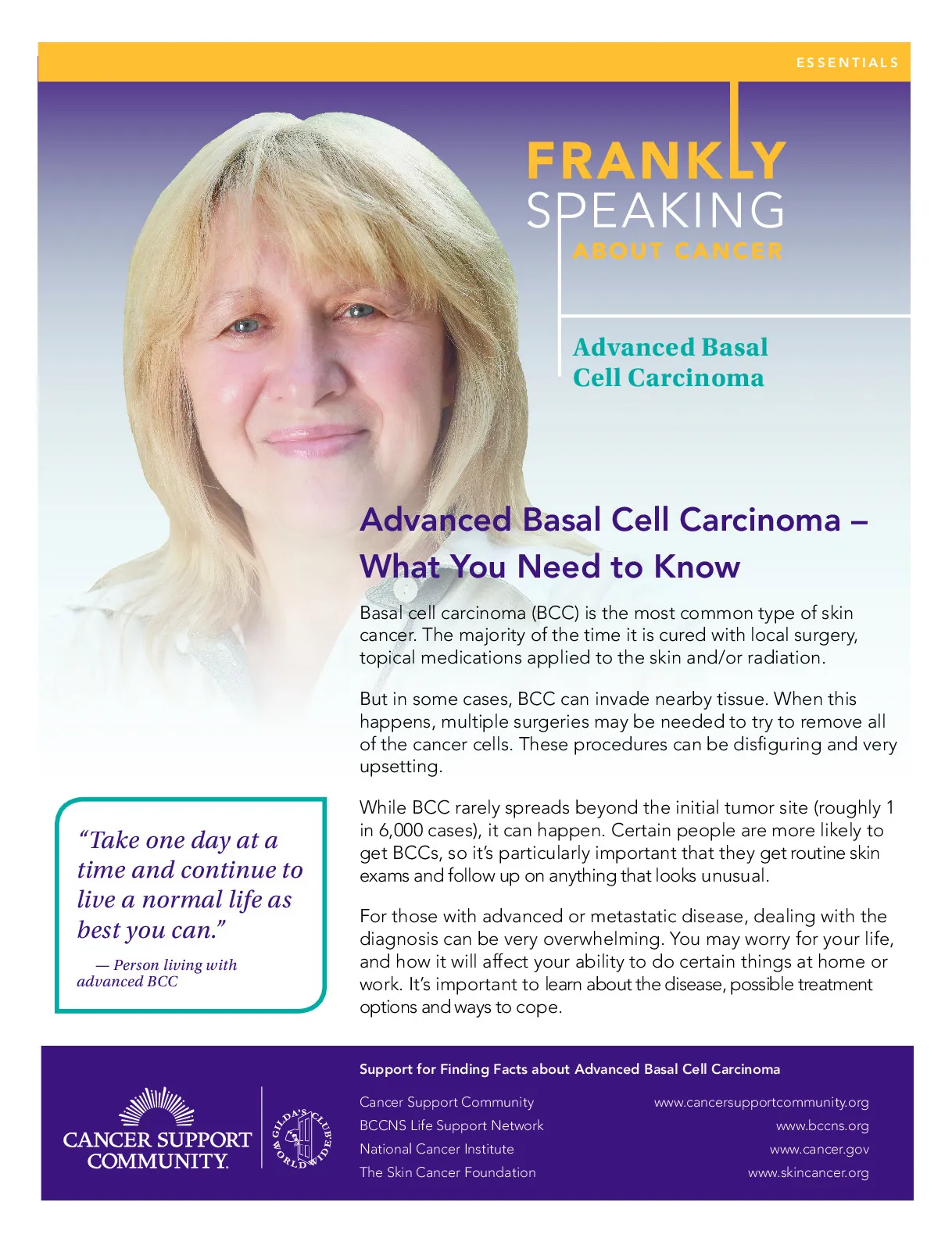 Frankly Speaking About Cancer: Metastatic Basal Cell Carcinoma