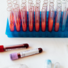 blood samples in vials